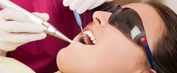 Ортопедическая стоматология — съемные протезы