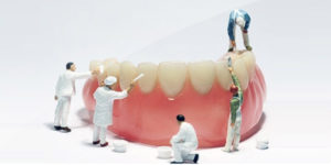 Ортопедическая стоматология — несъемные протезы