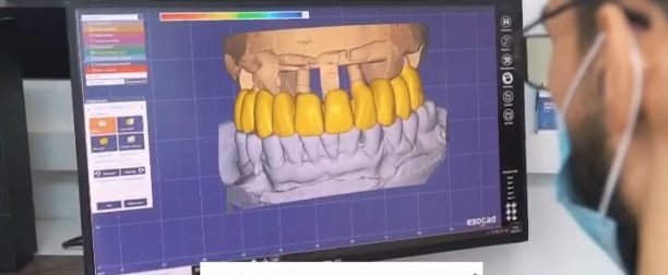 Обновленная зуботехническая лаборатория